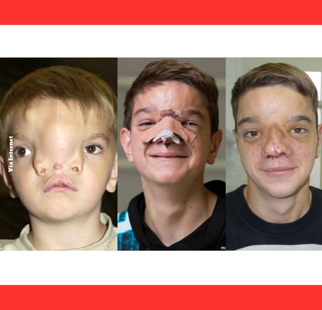 ONE SOLDIER’S VOW: 13 Years of Surgeries That Rewrote a Boy’s Destiny